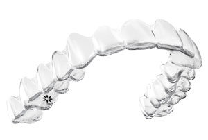 aligners