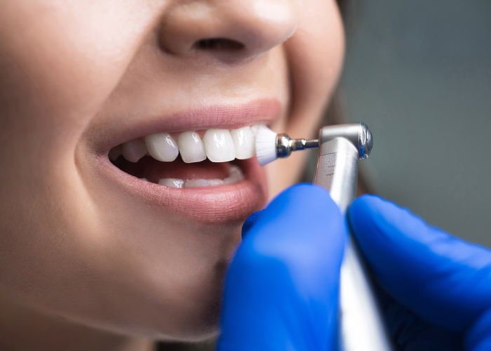 Dental Cleanings & Exams