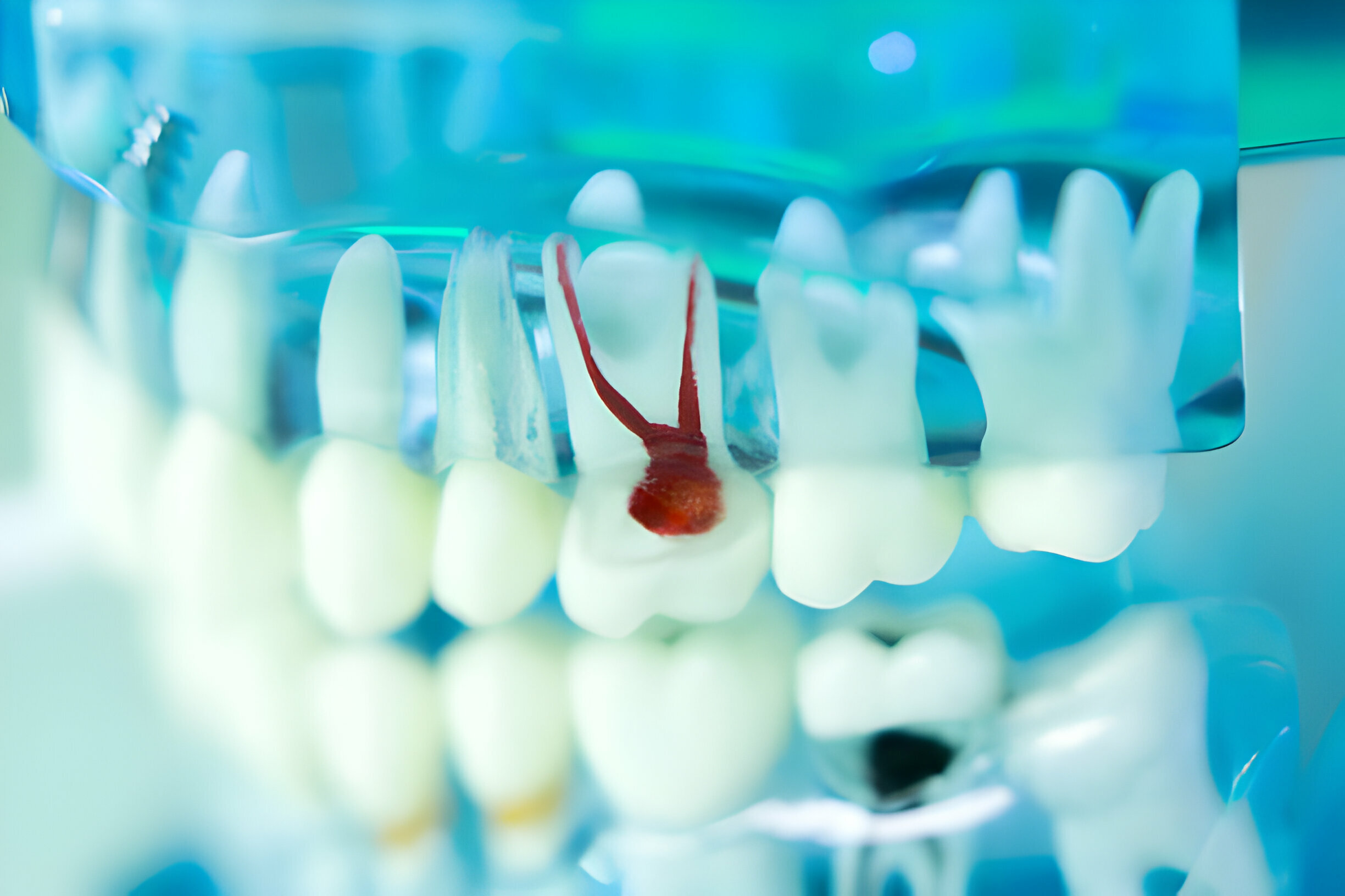 The Ultimate Guide To Tupelo Endodontics_FI