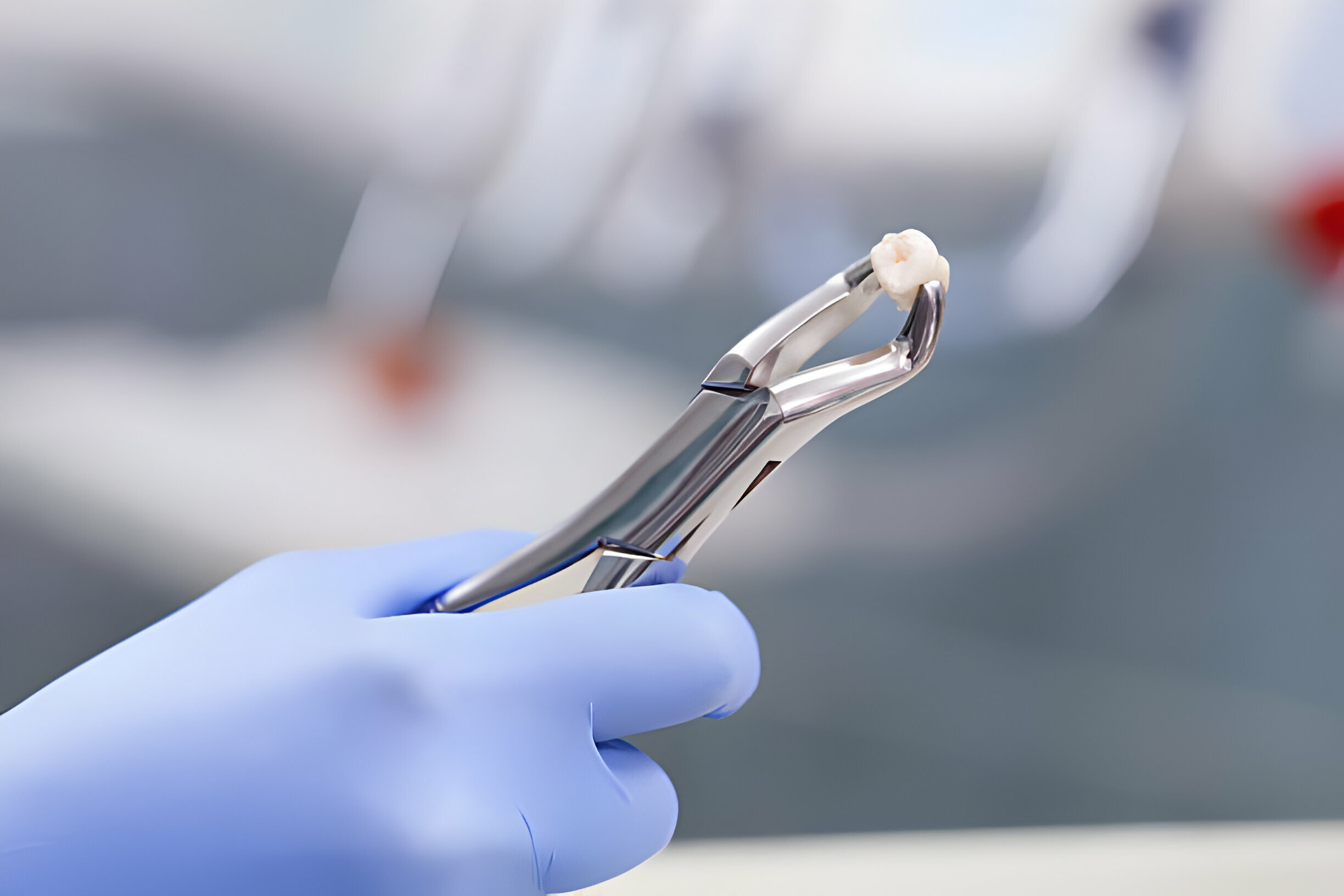 Tooth Care Extraction Tips by Main Street Family Dentistry_FI