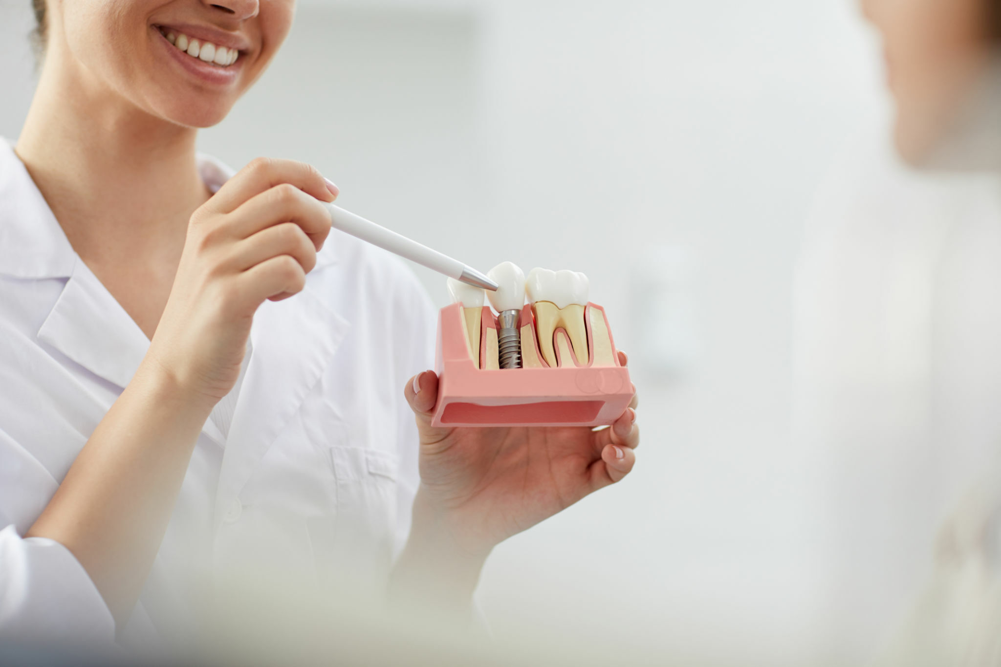 A Comprehensive Guide To Dental Implants In Tupelo, MS_FI