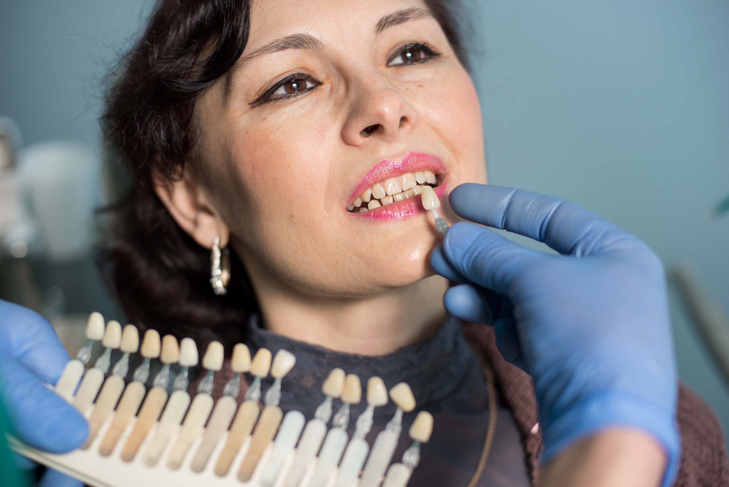 Dental Veneers Transform Your Smile (2)