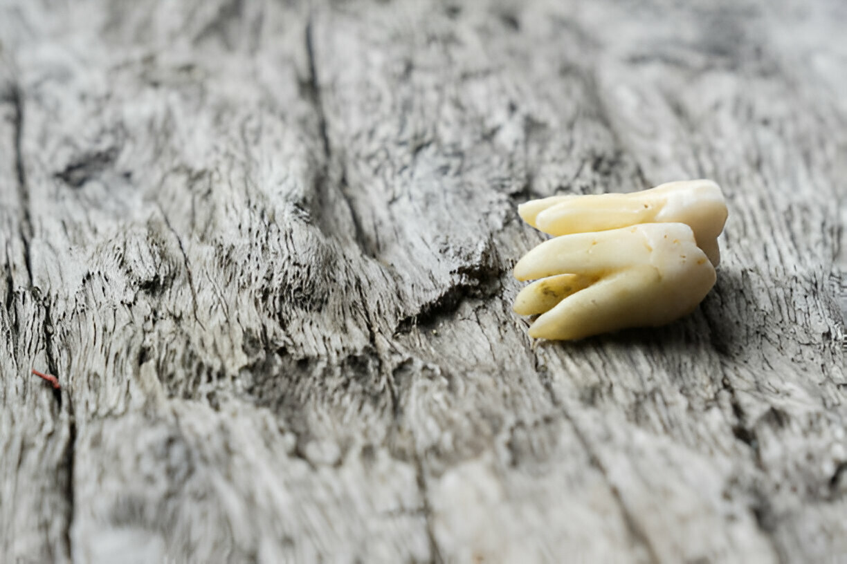 How to Choose the Right Dentist for Your Tooth Extraction_FI
