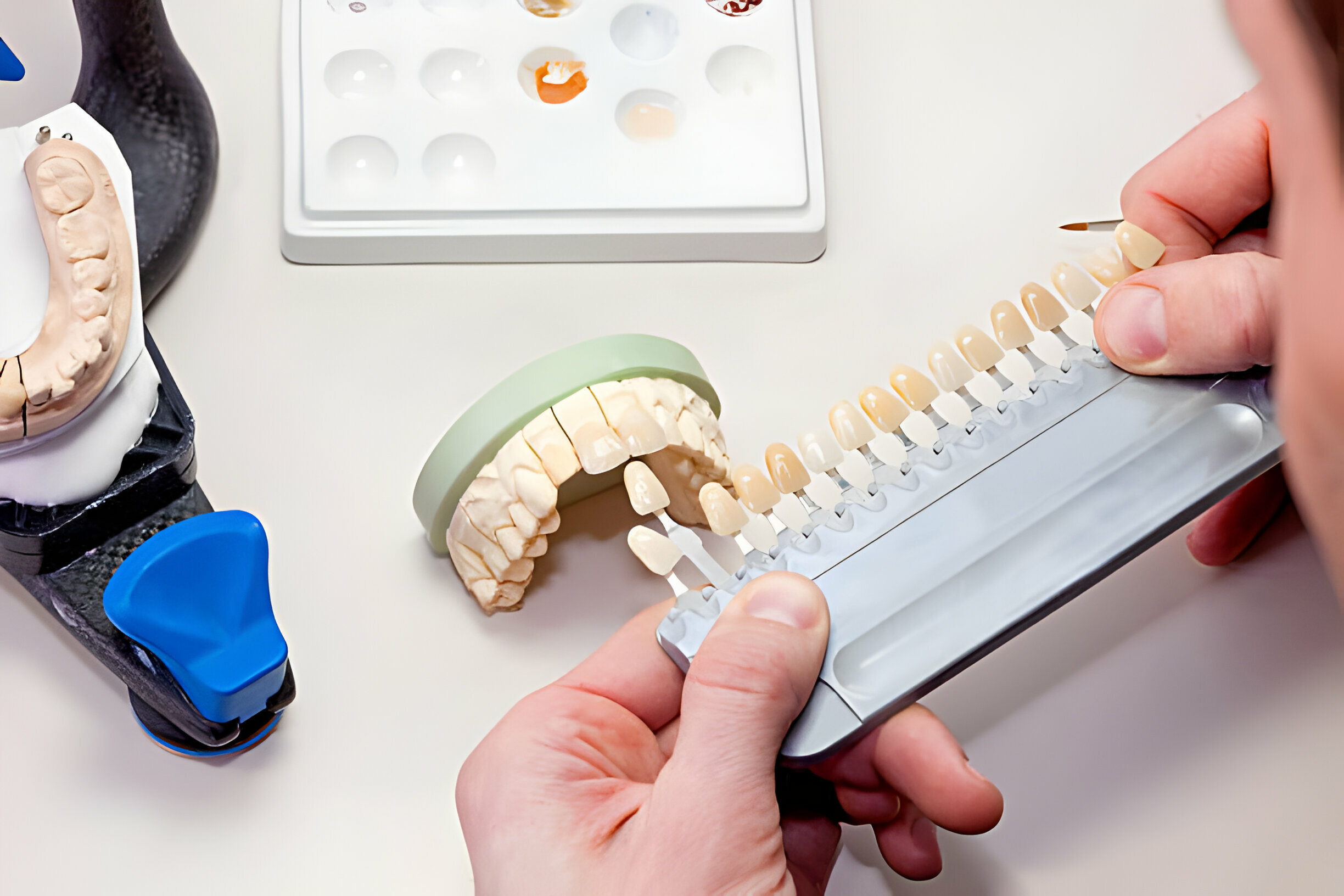 Tupelo EMAX Veneers: Find Your Perfect Smile With A Local Dentist_FI