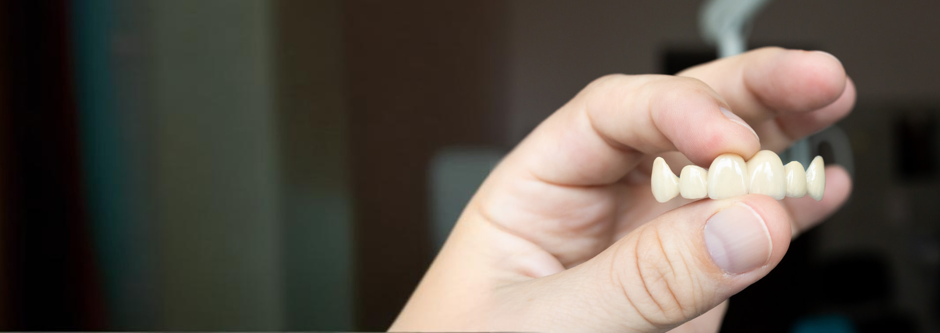 Dental Bridges Banner Image