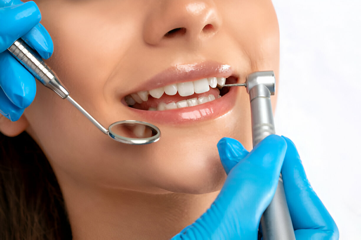 The Vital Role of Professional Dental Cleanings in Your Long-Term Oral Health at Main Street Dentistry in Tupelo, MS_FI